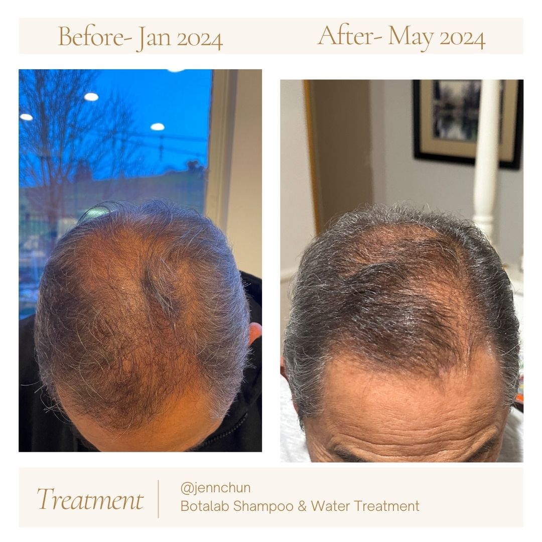 dramatic hair growth after 2 months of korean skincare haircare